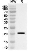 Western blot analysis was performed using anti-Mouse NODAL polyclonal antibody at 1ug/mL on recombinant Mouse NODAL (Catalog No. MV174012).