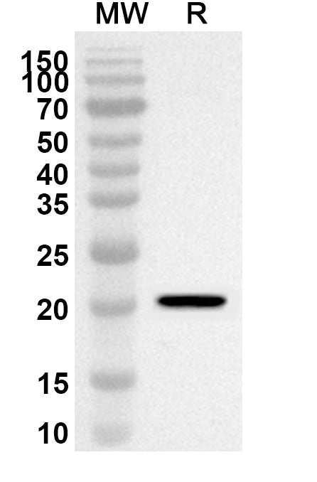 Western blot analysis was performed using anti-Mouse NODAL polyclonal antibody at 1ug/mL on recombinant Mouse NODAL (Catalog No. MV174012).
