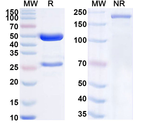 Flow-cytometry using anti-mouse SOST antibody.SOST Transfected CHO cells were stained with an irrelevant antibody (Blue Histogram) or an anti-mouse SOST antibody monoclonal antibody (Catalog # MV185013 ,Green Histogram) at a concentration of 5 µg/ml for 30 mins at RT. After washing, bound antibody was detected using a FITC conjugated goat anti-mouse antibody (Catalog # MF690414) and cells analysed on a NovoCyte Flow Cytometer.