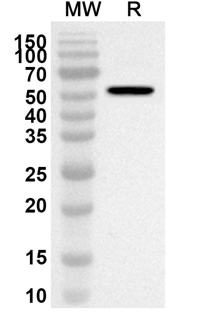 Western blot analysis was performed using anti-Mouse KLB/Beta-klotho polyclonal antibody at 1ug/mL on recombinant Mouse KLB/Beta-klotho (Catalog No. MV266012).