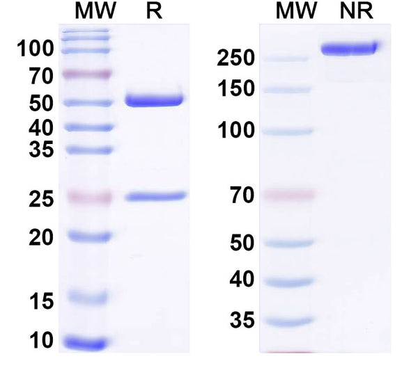 SDS-PAGE for Anti-Mouse PCSK9 Antibody (mAb1)