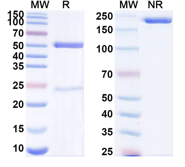 SDS-PAGE for Anti-Mouse PCSK9 Antibody (SAA0271).