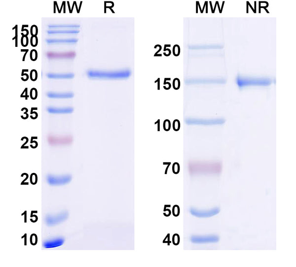 SDS-PAGE for Anti-Mouse CD229/LY9 Antibody (H03)