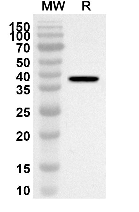 Western blot analysis was performed using anti-Mouse FOXP3 polyclonal antibody at 1ug/mL on recombinant Mouse FOXP3 (Catalog No. MV388012).