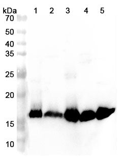 Anti-Mouse PHPT1 Polyclonal Antibody – Lane 1: Mouse skeletal muscle lysateLane 2: Mouse brain lysateLane 3: Rat liver lysateLane 4: Rat heart lysateLane 5: Rat skeletal muscle lysate
