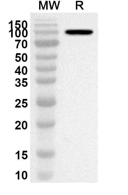 Western blot analysis was performed using anti-Mouse PADI4 polyclonal antibody at 1ug/mL on recombinant Mouse PADI4 (Catalog No. MV433012).