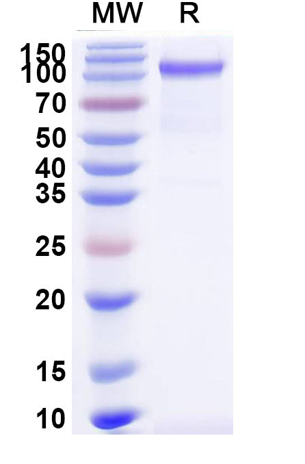 Recombinant Mouse CD100/SEMA4D Protein, C-His