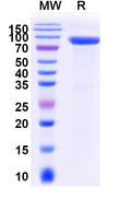 Recombinant Mouse SFRP5 Protein, C-Fc
