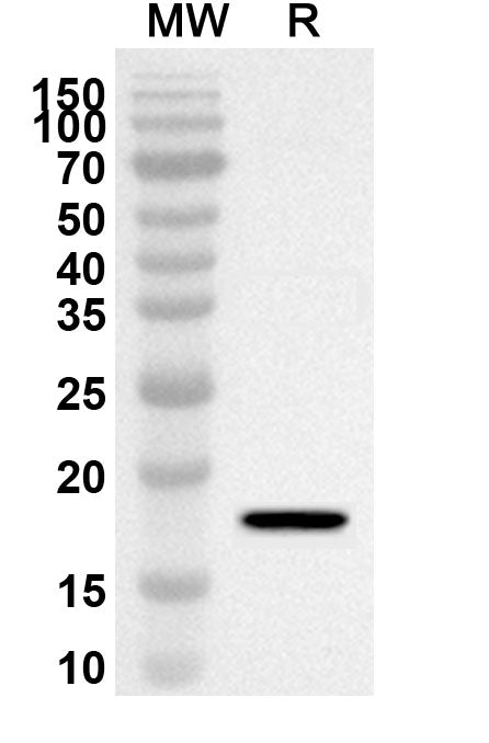 Western blot analysis was performed using anti-Mouse SEMA4B polyclonal antibody at 1ug/mL on recombinant Mouse SEMA4B (Catalog No. MV655012).