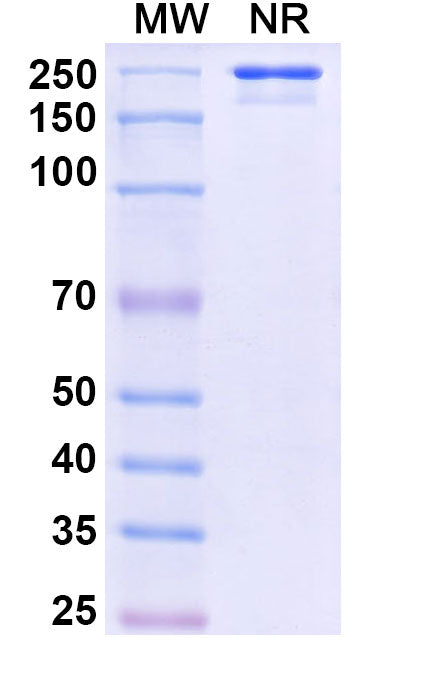 Flow-cytometry using anti-mouse CD248 antibody.CD248 Transfected CHO cells were stained with an irrelevant antibody (Blue Histogram) or an anti-mouse CD248 antibody monoclonal antibody (Catalog # MV681107 ,Green Histogram) at a concentration of 5 µg/ml for 30 mins at RT. After washing, bound antibody was detected using a FITC conjugated goat anti-human antibody (Catalog # HF690414) and cells analysed on a NovoCyte Flow Cytometer.