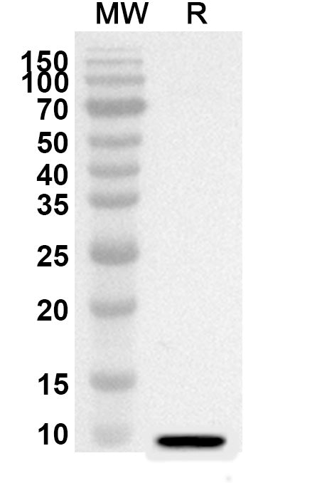 Western blot analysis was performed using anti-Mouse CCL28/MEC polyclonal antibody at 1ug/mL on recombinant Mouse CCL28/MEC (Catalog No. MV685012).
