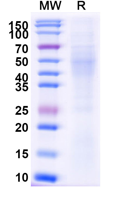 Recombinant Mouse VTCN1/B7-H4 Protein, C-His