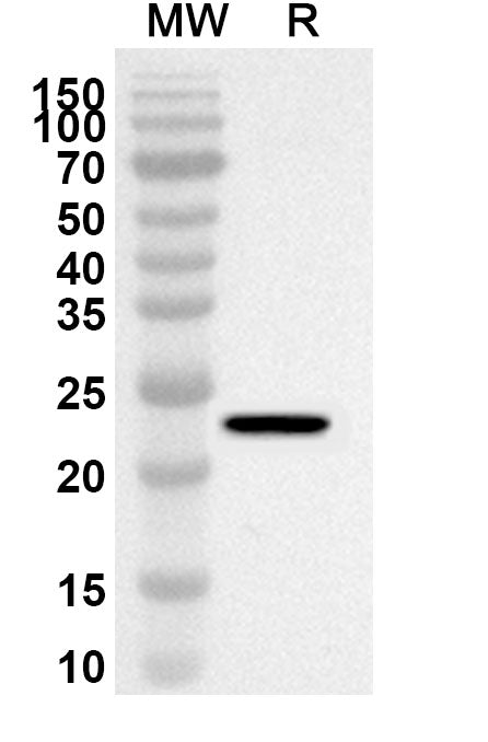 Western blot analysis was performed using anti-Mouse CD200R1L polyclonal antibody at 1ug/mL on recombinant Mouse CD200R1L (Catalog No. MV756012).