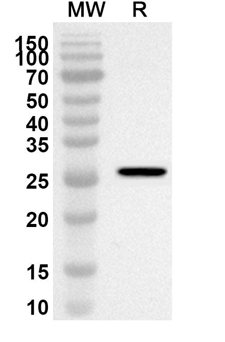 Western blot analysis was performed using anti-Mouse CD163 polyclonal antibody at 1ug/mL on recombinant Mouse CD163 (Catalog No. MV831012).