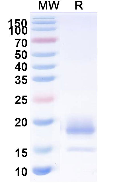 SDS-PAGE for Anti-Mouse CD274/PD-L1/B7-H1 Nanobody (C3)