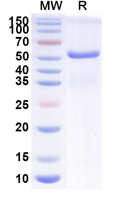 Recombinant Mouse EFNA5 Protein, C-Fc