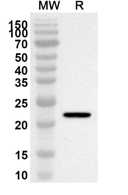 Western blot analysis was performed using anti-Mouse CCN3 polyclonal antibody at 1ug/mL on recombinant Mouse CCN3 (Catalog No. MW350012).
