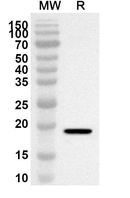 Western blot analysis was performed using anti-Mouse SELENOP polyclonal antibody at 1ug/mL on recombinant Mouse SELENOP (Catalog No. MW486012).