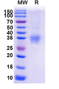 Recombinant Mouse EFNA3 Protein, C-His