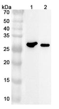 Anti-Mouse CDKN1A Polyclonal Antibody – Lane 1: Mouse heart lysateLane 2: Rat heart lysate