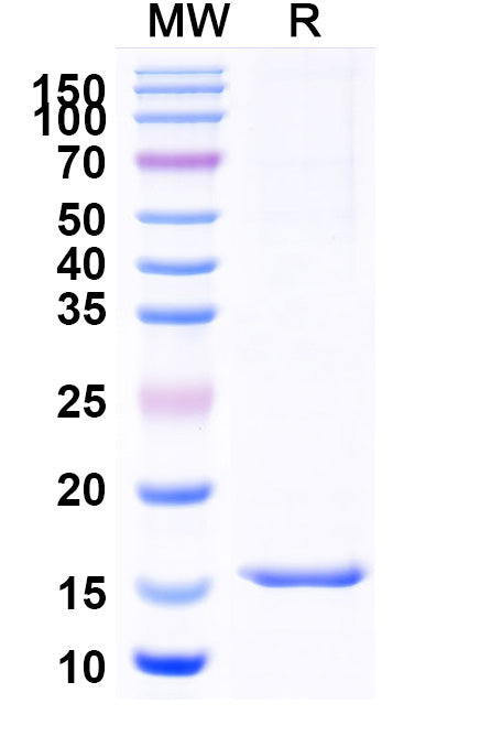 Recombinant Mouse GIPR/GIP-R Protein, N-His