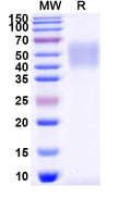 Recombinant Mouse CD80 Protein, C-His