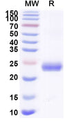 Recombinant Mouse EFNA4 Protein, C-His