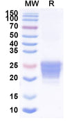 Recombinant Mouse CD70 Protein, C-His