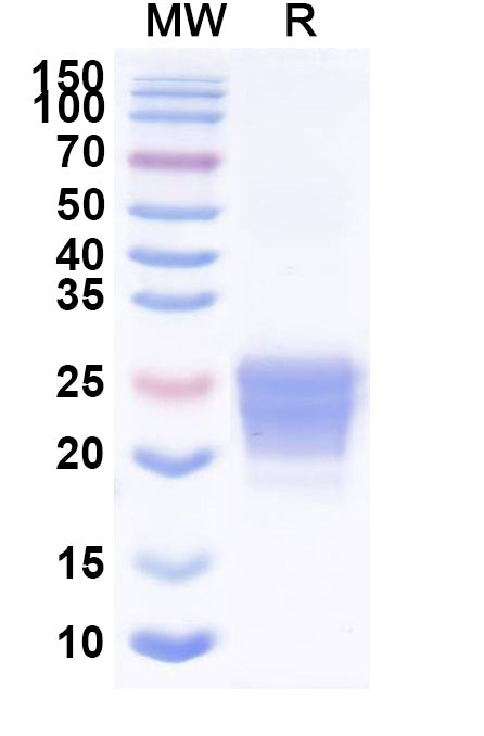 Recombinant Mouse CD70 Protein, C-His