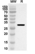 Western blot analysis was performed using anti-Mouse FCGRT/FCRN polyclonal antibody at 1ug/mL on recombinant Mouse FCGRT/FCRN (Catalog No. MX061012).