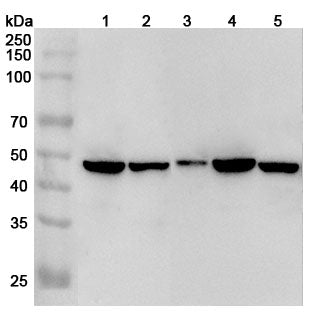 Western blot analysis was performed using anti-IL1RL1 polyclonal antibody at 1µg/ml on various samples.
Lane 1: Hela cell lysate
Lane 2: SGC-7901 cell lysate
Lane 3: HUVEC cell lysate
Lane 4: HepG2 cell lysate
Lane 5: Mouse brain lysate