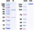 SDS-PAGE for Anti-Mouse CD156b/ADAM17 Antibody (A12)