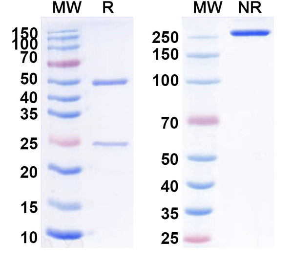 SDS-PAGE for Anti-Mouse CD156b/ADAM17 Antibody (A12)