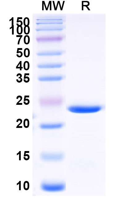Recombinant Mouse BID Protein, N-His