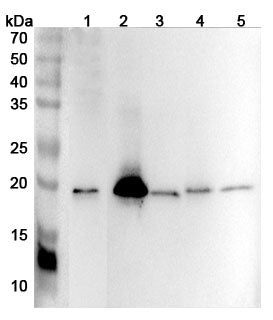 Western blot analysis was performed using anti-BID polyclonal antibody at 1ug/mL  on various samples.
Lane 1: Jurkat cell lysate
Lane 2: Mouse spleen lysate
Lane 3: Mouse thymus lysate
Lane 4: Rat spleen lysate
Lane 5: Rat thymus lysate