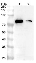 Western blot analysis was performed using anti-IL5RA polyclonal antibody at 1ug/mL on various samples.
Lane 1: HL-60 cell lysate
Lane 2: Mouse lung lysate