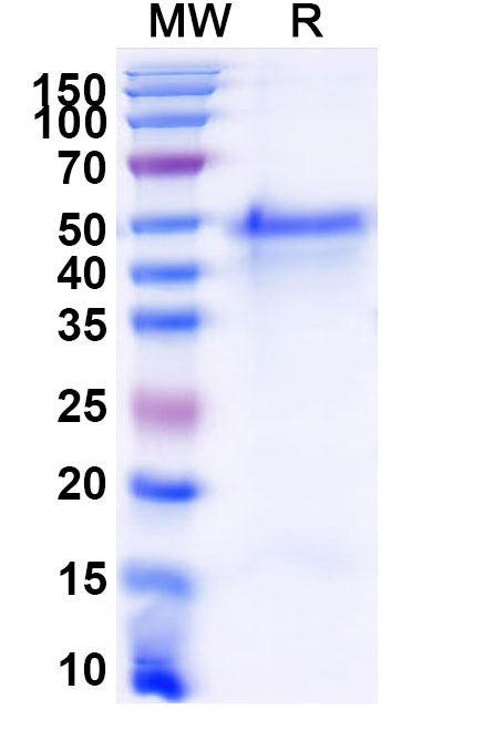 Recombinant Mouse GSDMD/Gasdermin-D Protein, N-His-SUMO