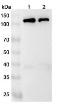 Anti-Mouse BCAR1 Polyclonal Antibody – Lane 1: A431 cell lysateLane 2: Hela cell lysate