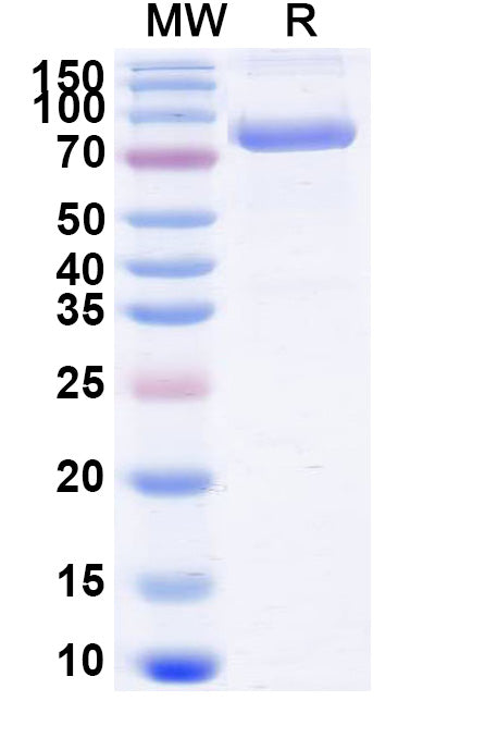 Recombinant Mouse CD71/TFRC Protein, C-His