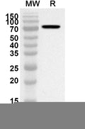 Western blot analysis was performed using anti-Mouse CD71/TFRC polyclonal antibody at 1ug/mL on recombinant Mouse CD71/TFRC (Catalog No. MY036012).