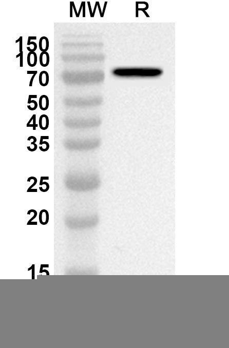 Western blot analysis was performed using anti-Mouse CD71/TFRC polyclonal antibody at 1ug/mL on recombinant Mouse CD71/TFRC (Catalog No. MY036012).