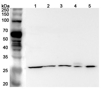 Western blot analysis was performed using anti-APCS polyclonal antibody at 1ug/mL  on various samples.
Lane 1: 293T cell lysate
Lane 2: Hela cell lysate
Lane 3: HepG2 cell lysate
Lane 4: Mouse liver lysate
Lane 5: Mouse kidney lysate