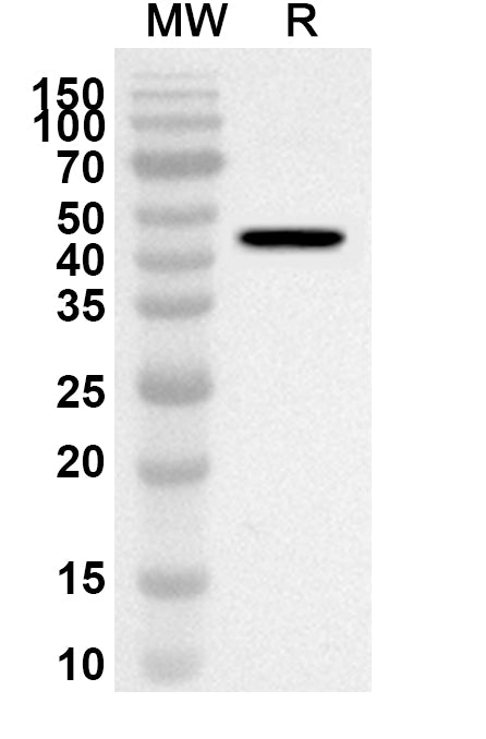 Western blot analysis was performed using anti-Mouse FABP1 polyclonal antibody at 1ug/mL on recombinant Mouse FABP1 (Catalog No. MY138012).