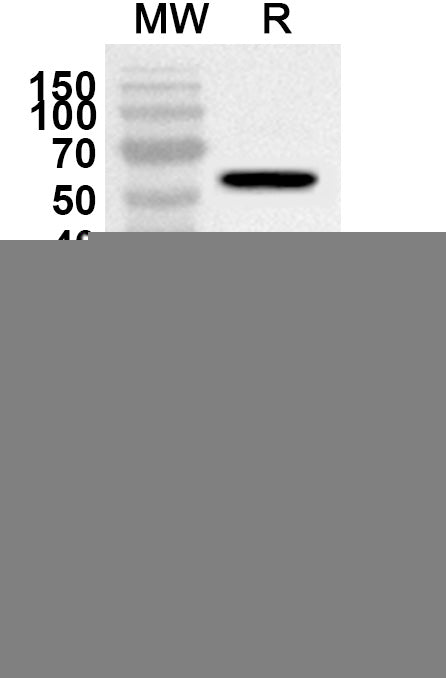 Western blot analysis was performed using anti-Mouse CD117/KIT polyclonal antibody at 1ug/mL on recombinant Mouse CD117/KIT (Catalog No. MY163012).