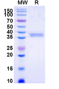 Recombinant Mouse CD45/PTPRC Protein, C-Fc