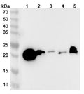 Western blot analysis was performed using anti-GPX1 polyclonal antibody at GPX1 on various samples.
Lane 1: Mouse liver lysate
Lane 2: Mouse kidney lysate
Lane 3: Mouse spleen lysate
Lane 4: Mouse lung lysate
Lane 5: Rat liver lysate