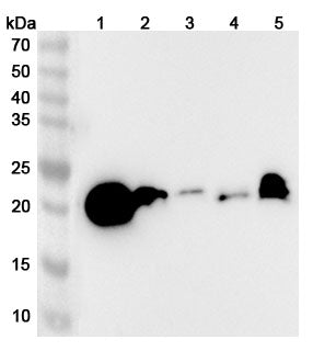 Western blot analysis was performed using anti-GPX1 polyclonal antibody at GPX1 on various samples.
Lane 1: Mouse liver lysate
Lane 2: Mouse kidney lysate
Lane 3: Mouse spleen lysate
Lane 4: Mouse lung lysate
Lane 5: Rat liver lysate