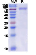 Recombinant Mouse TACSTD2/TROP2 Protein, C-Fc