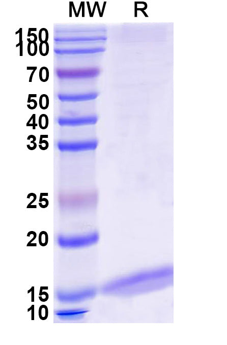 SDS-PAGE for Anti-Mouse Albumin/Alb Nanobody (MSA21)