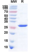 Recombinant Mouse CD74 Protein, N-His